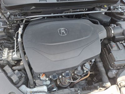 2015 Acura TLX V6 Tech